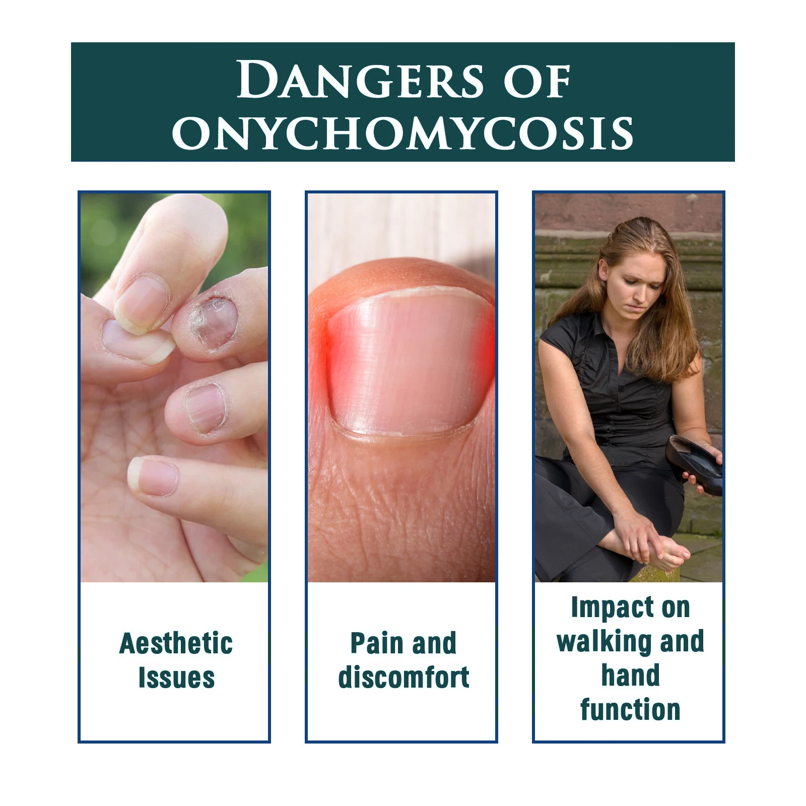 Private Label Anti Fungal Nail Fungus Treatment Repair Pens for Toenail Fungus Infection and Fingernail
