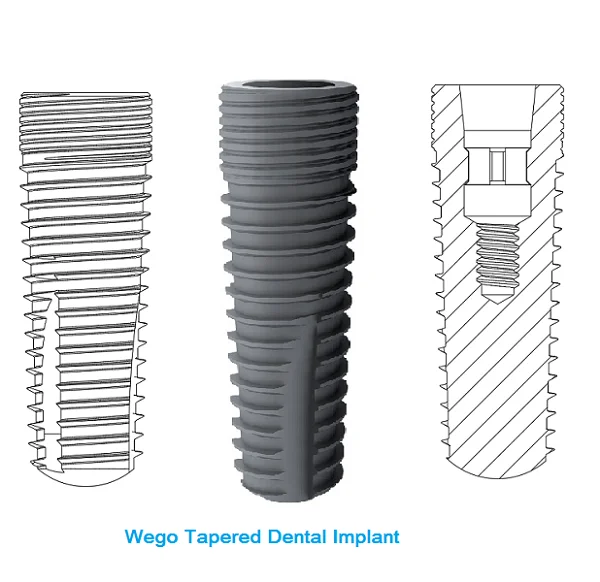Приспособление для зубных протезов Wego, система имплантации зубов CE ISO, стандартная платформа S.L.A, внутреннее соединение поверхности