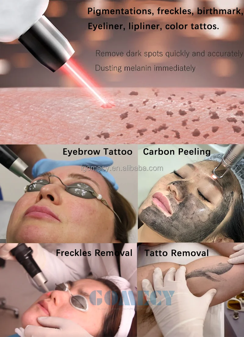 GOMECY-Professional-PicoLaser-532-755-1320-1064-Pico-Second-Tattoo-Removal-Laser-Machine-Pico-Laser-Tattoo-Removal-Picosecond