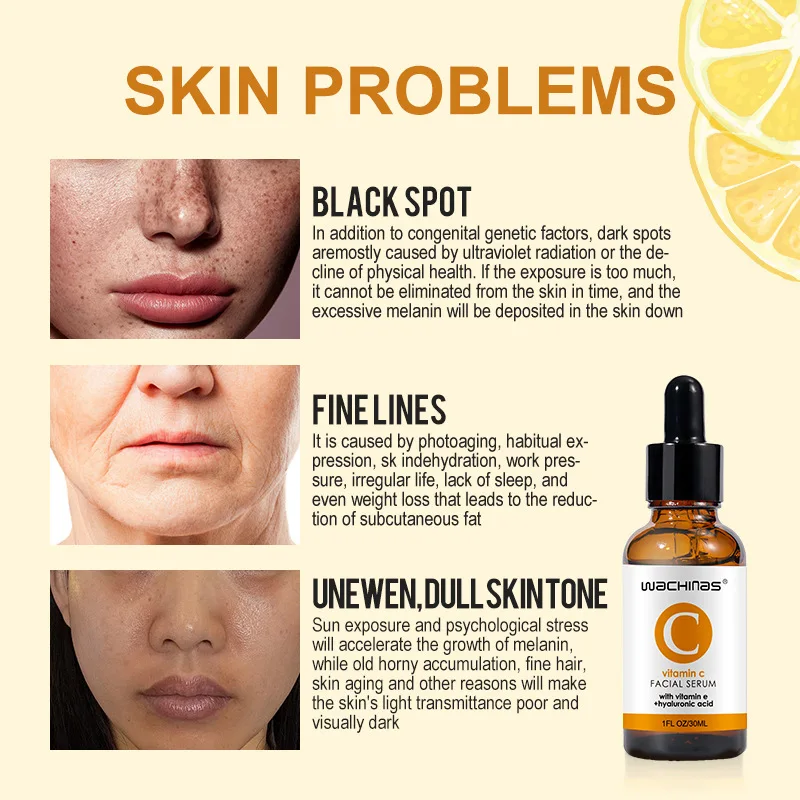 Vitamin C Facial Serum brightening skin color removing yellow and firming anti-wrinkle improvement dark repair color spot