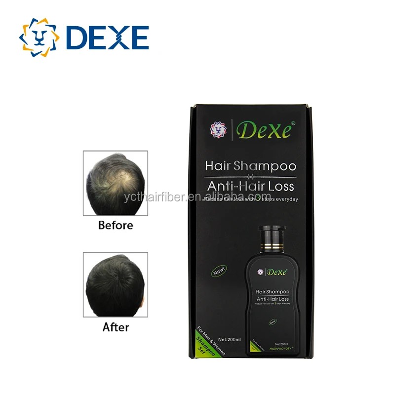 anti hair loss shampoo with factory direct sale price