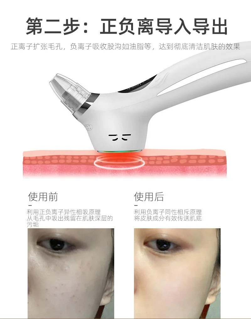 NEW 2024 Hot and cold compres Hole Vacuum Black head Machine Large Battery Gentle SmallBubble Cleanser Beauty Equipment