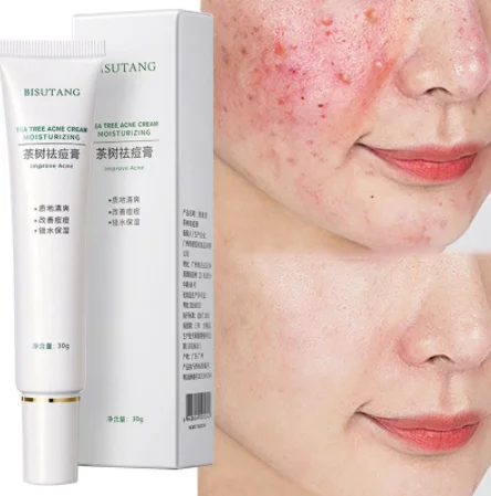 Herbal Acne Removal Face Cream Oil Control Anti-Acne Gel Treatment Acne Mark Skin Care Whitening Eliminate Pimples Facial Cream