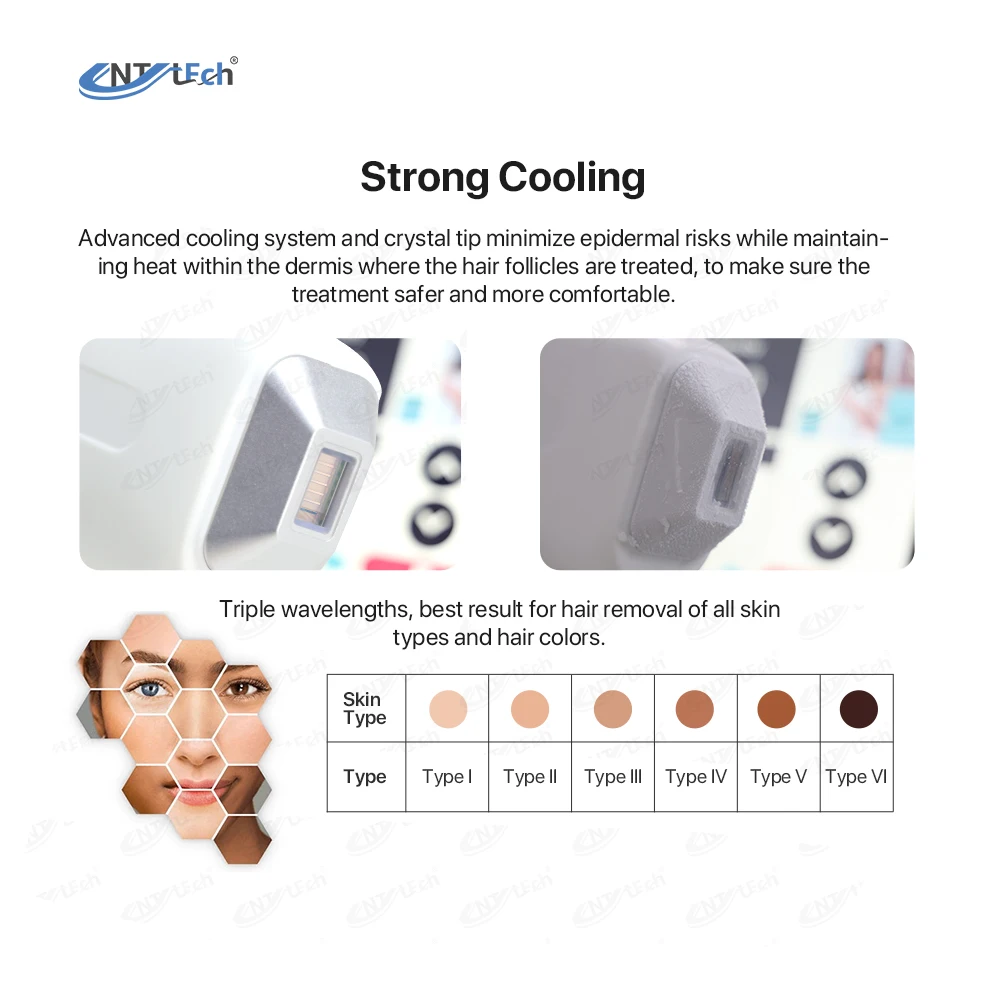 Aesthetic medicine 808nm diode laser hair removal permanent machine for hair removal pain free