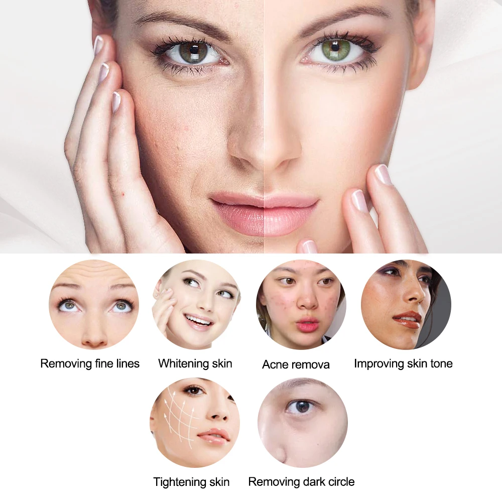 Sonar Magnetic Energy Anti-Aging Roller Device Cryo Electroporation Beauty Device with Needleless Frequency