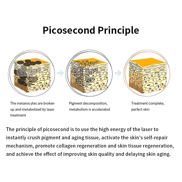 808nm Nd Yag Ice Titanium Diode Trio Laser 3 Waves Lazer Hair Removal 808nm Picosecond Tattoo Removal Machine