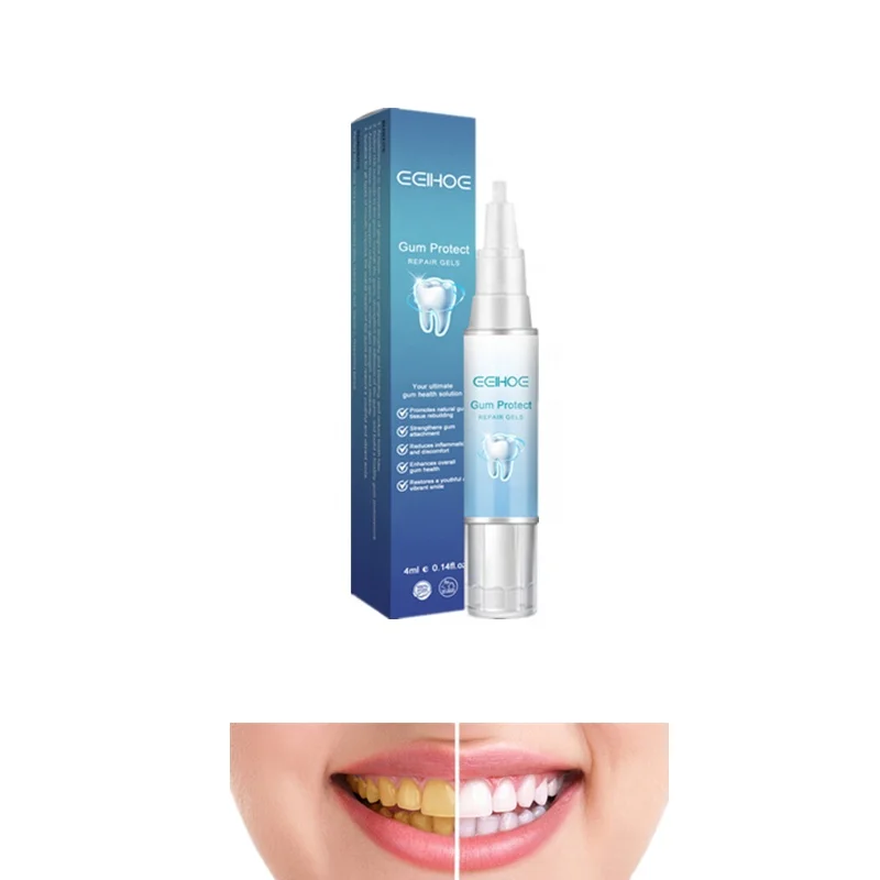 EELHOE teeth whitening gel pen tooth stain tartar removing yellow teeth halitosis gingival inflammation relief gel professional