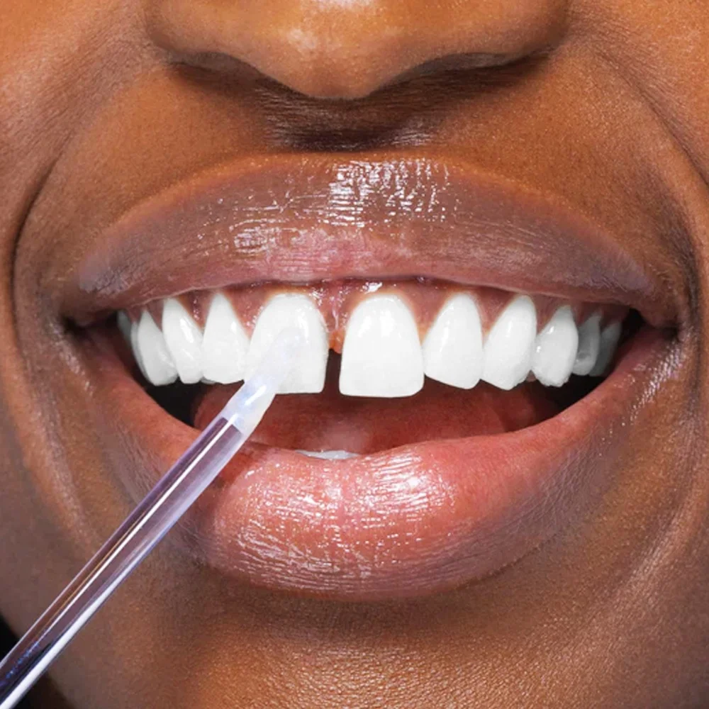 Private Label Wholesale Tooth Brighten Stick Purple Teeth Whitening Gloss Instant Whitening Wand