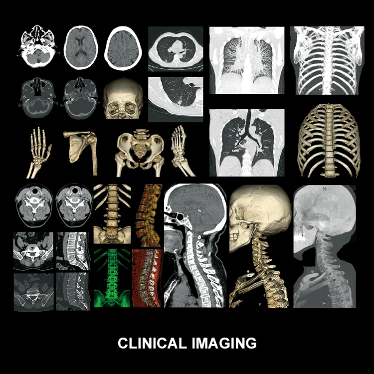 China Manufacturer Supply Medical Multi-Functional CT Scanner Professional Hospital CT Scan Machine