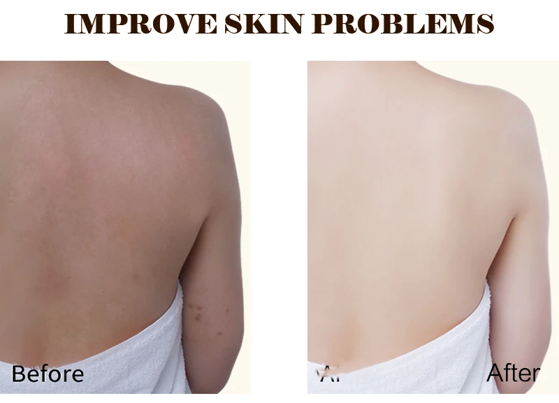 Hot selling high dose l-glutathione  capsules skin whitening pills for black skin