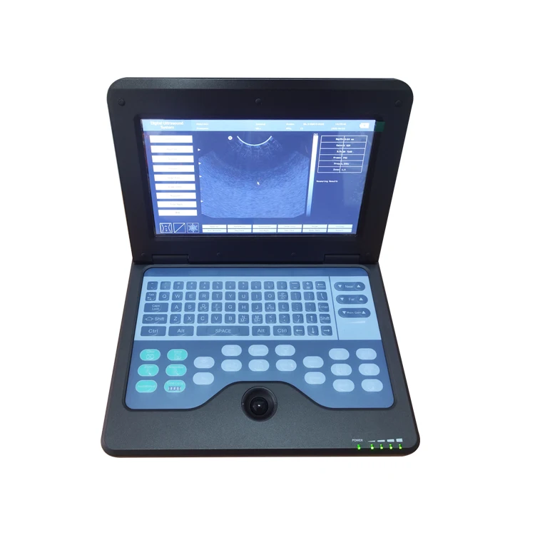 Laptop ultrasound system full digital ultrasound scanner
