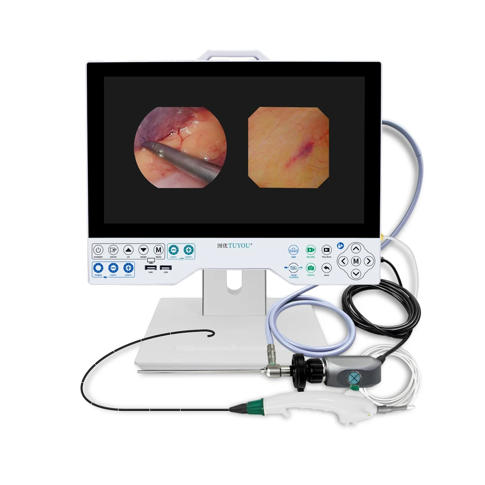 TUYOU 1080P 15.6 Inch Rigid and Flexible All In One Endoscope Camera System Use in ENT,Hystoscope,cystoscope Surgery