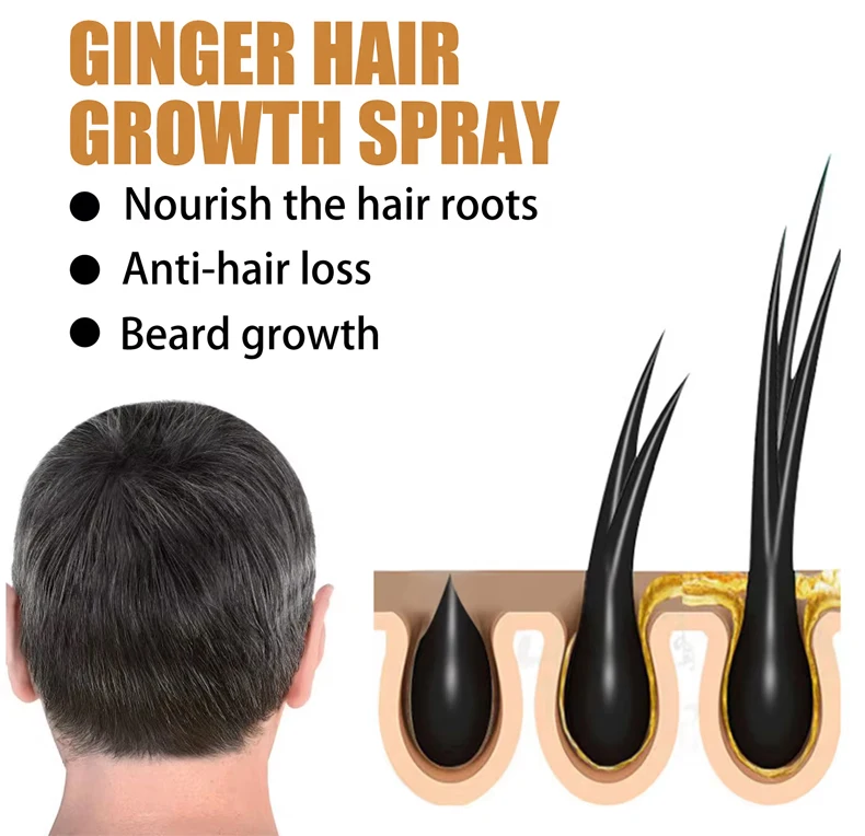 OVILZ Organic Ginger Hair Growth Oil Serum Keratin Herbal Infused Hair Regrowth Care Serum for women