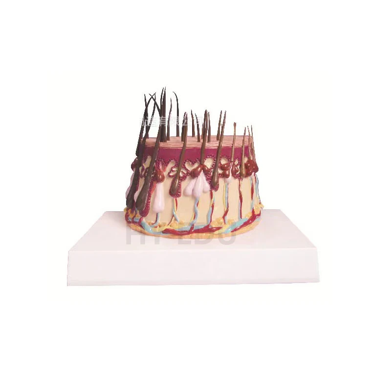 Medical Science enlarged biological diseased  skin cutaneum carcinoma Model 3D anatomical model