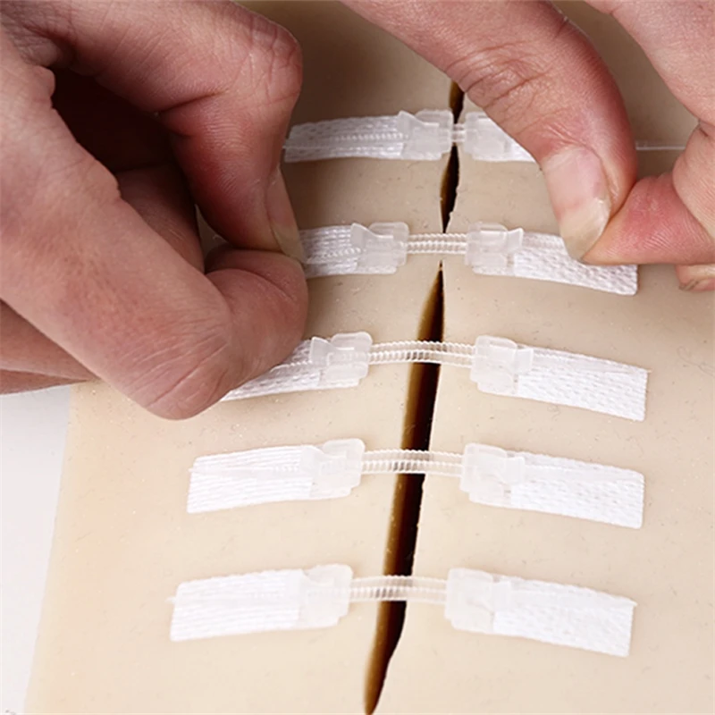 Medical Supply Surgical Medical Devices Non-invasive Adhesive Wound Closure Zipper