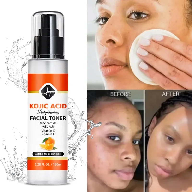 Hot selling KOJIC  Private Label Vitamin E Moisturizing Brightening KOJC ACID FACE water Most popular in Witch Hazel Skin Toner
