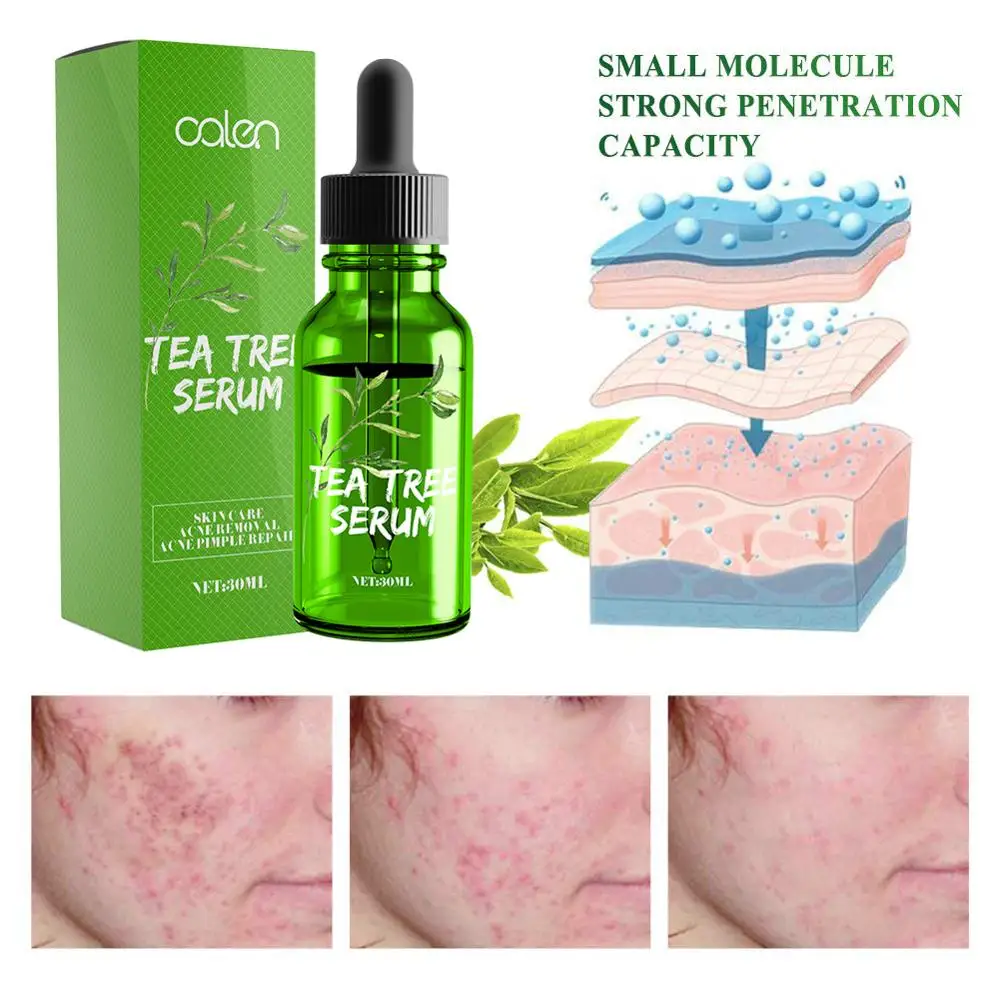 
OEM Customized Acne Treatment Scar Removal Face Care Organic Tea Tree Serum 