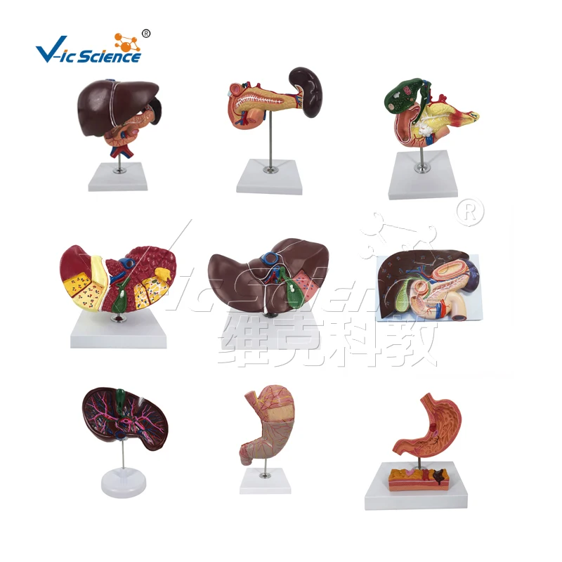 anatomical models for medical teaching stomach With Ulcers Anatomy Model human digestive system model