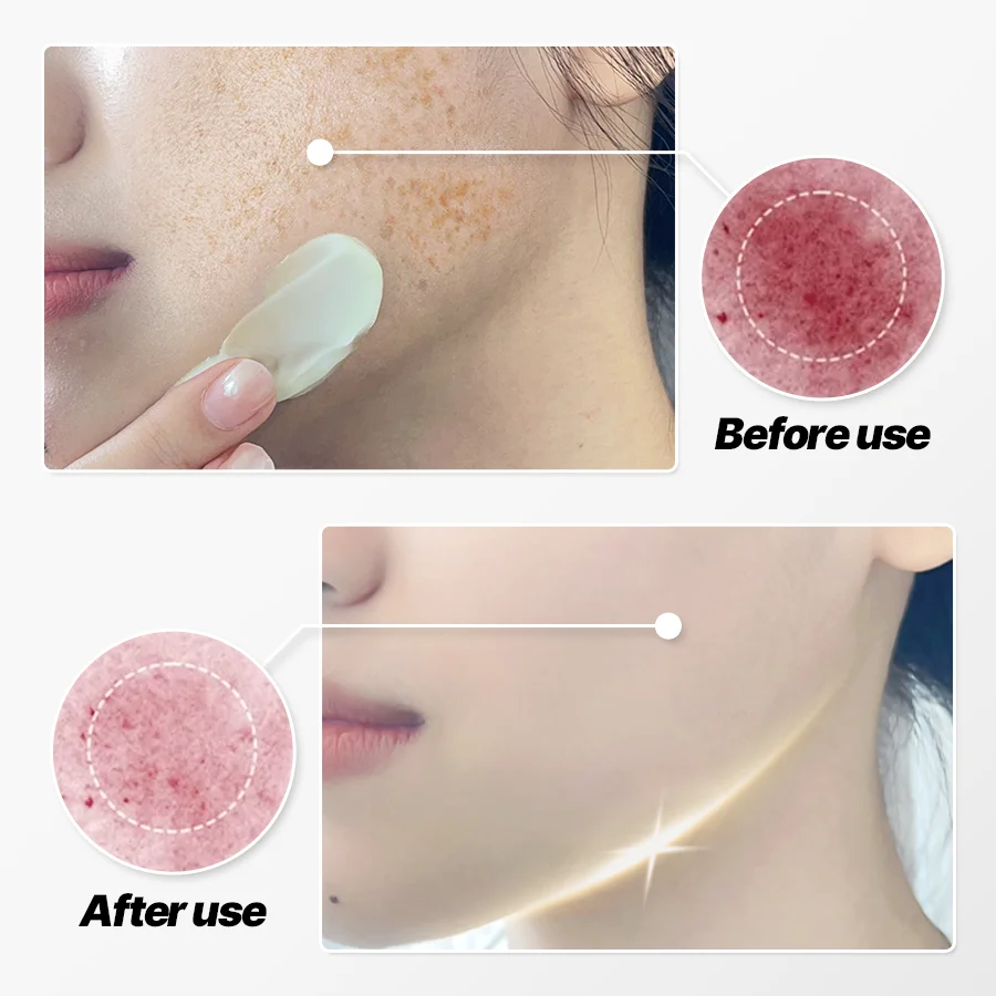 Collagen Vitamin E Pearl Infused Face Cream Pimples Melasma Dark Spots Freckles Removal-Strong Bleaching Whitening Effect