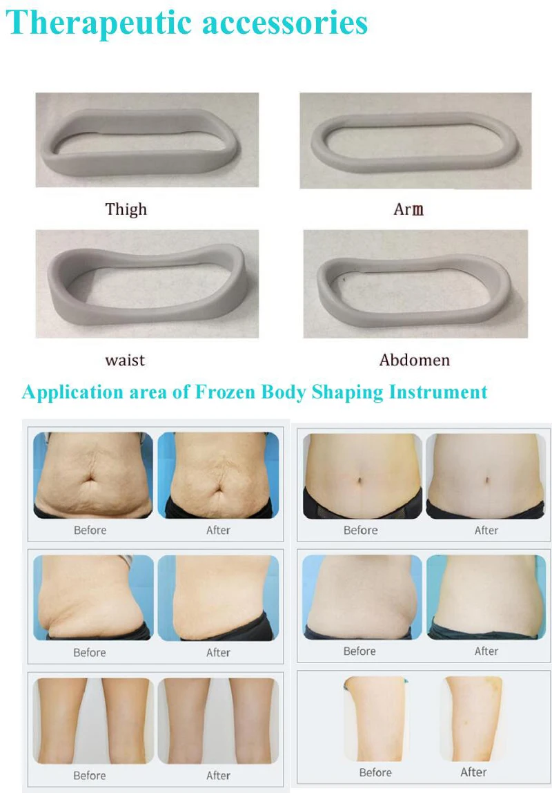 AU-A15 Spa Use Skin Cryo Therapy Machine Skin Cooling Frozen Fat Reduction Machine
