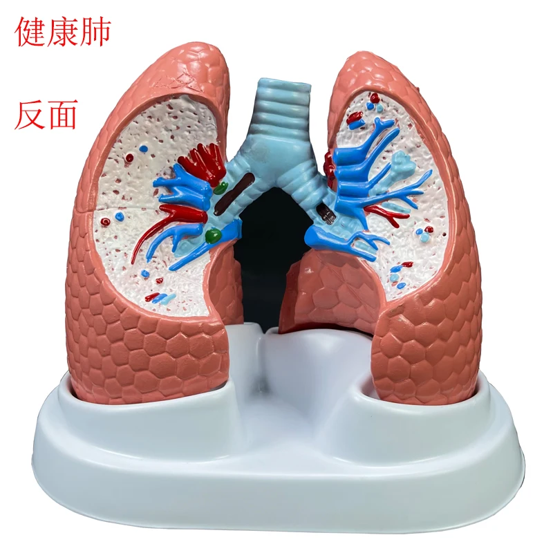 Human anatomical model Lung model Teaching resources