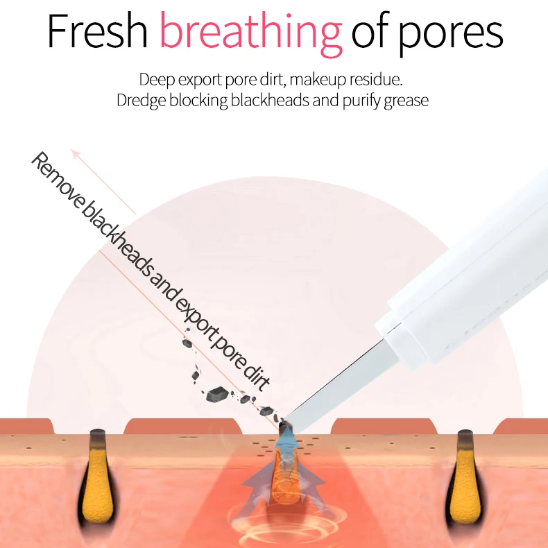 New Design Remove Blackheads Instrument Ultrasonic Sonic Blackhead Instrument