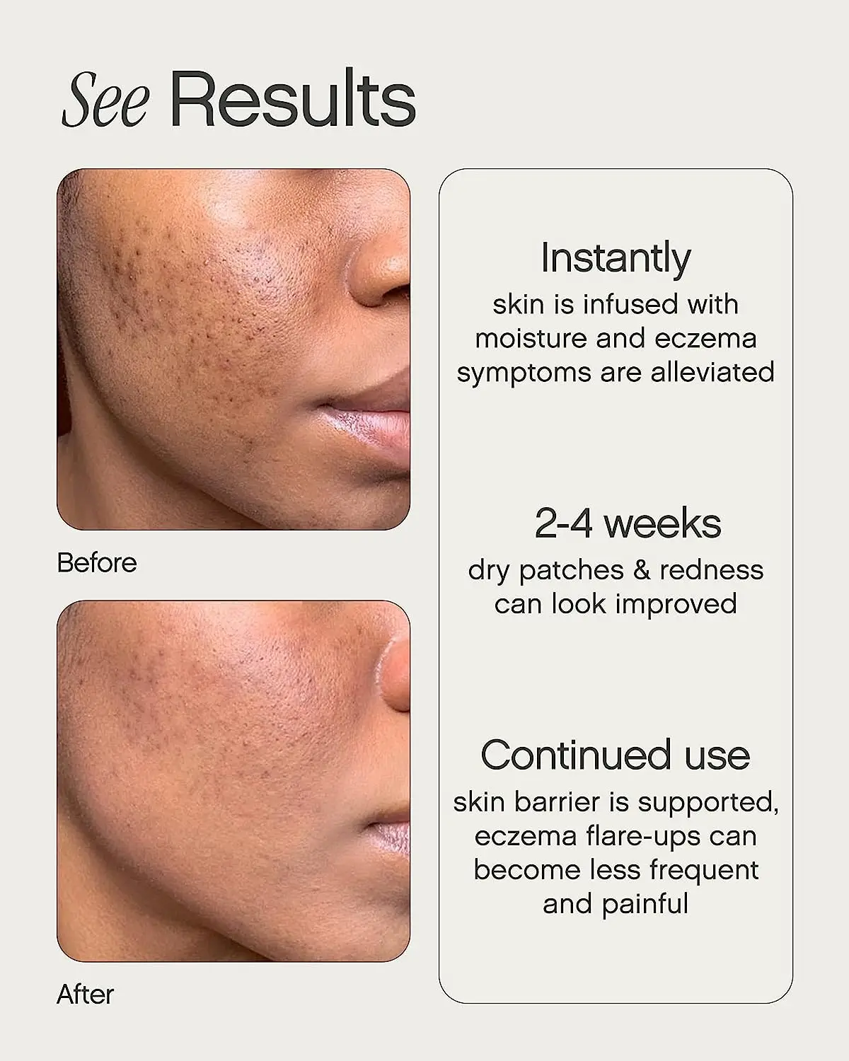 Topicals Like Butter Moisturizer for Dry, Sensitive & Eczema-Prone Skin - Soothing Instant Moisturizer