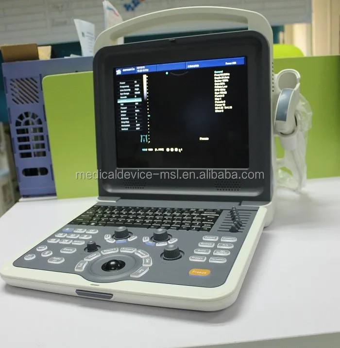 Ультразвуковой аппарат