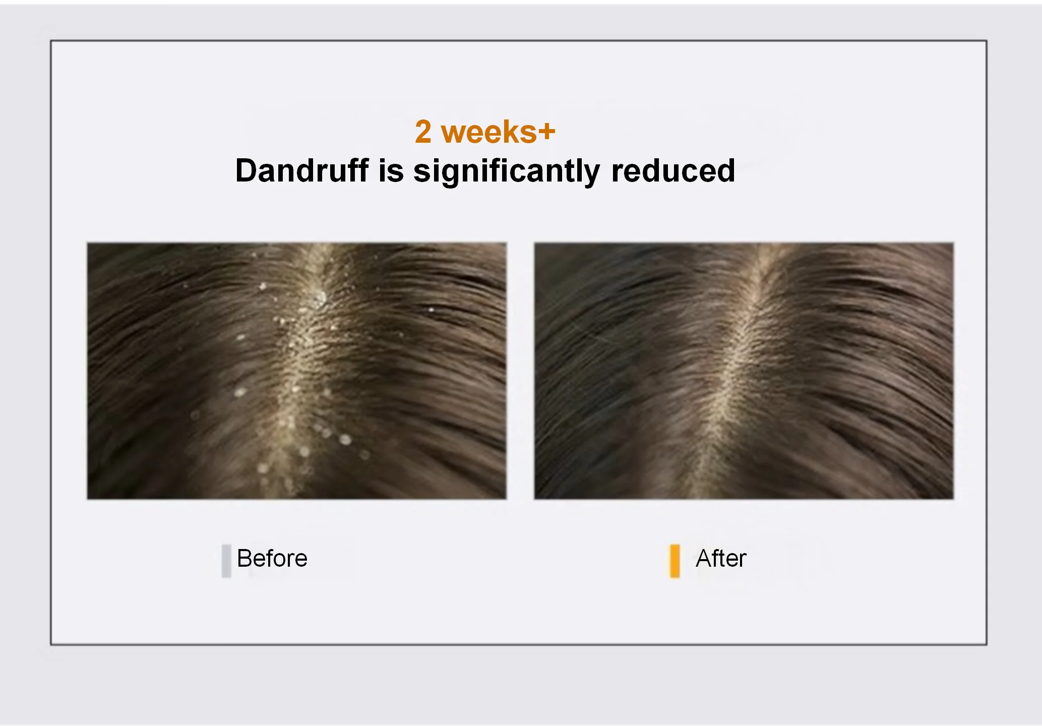 New Selenium Disulfide Anti-Dandruff Shampoo Adults Oil-Control Volumizing Hair Wash Refreshing Moisturizing Nourishing