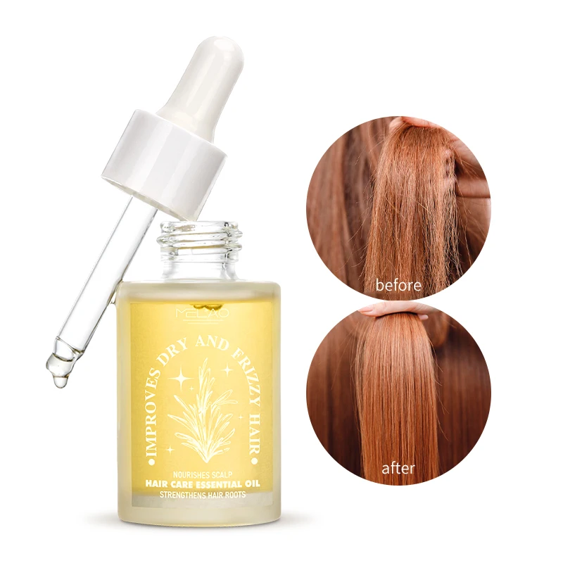 MELAO Private Label Wholesale 100% Natural Formula Nourishing Scalp Elixirs Hair Care Loss Treatment Hair Growth Oil Serum