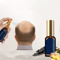 Anti Loss Itching Scalp Elixirs Herbal Instant Hair Growth Products Spray Oil For Black Women Private Label