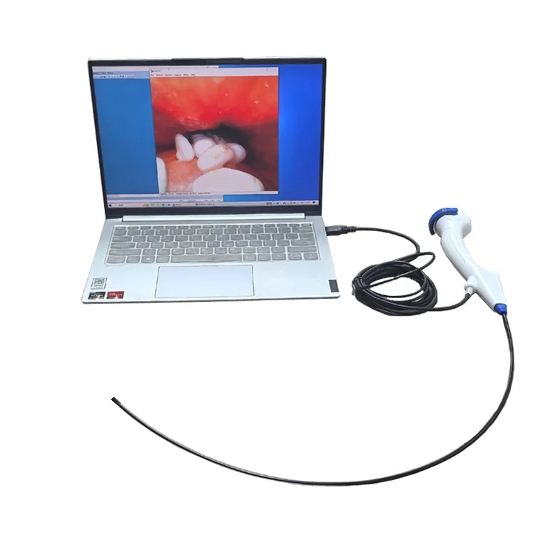 New Arrival Durable Wholesale Medical Flexible bronchoscopy Endoscope Camera Hot Selling veterinary endoscope