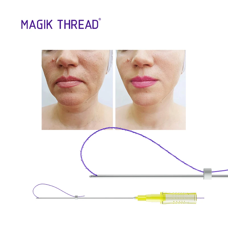 Magik Thread CE, оптовая продажа, 19G 100 мм pdo thread 6d cog pdo thread от производителей