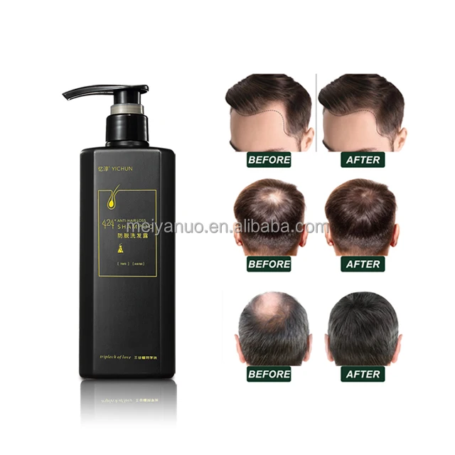 Oem High Quality Hair Care Shampoo Ginger Anti Hair Loss Shampoo