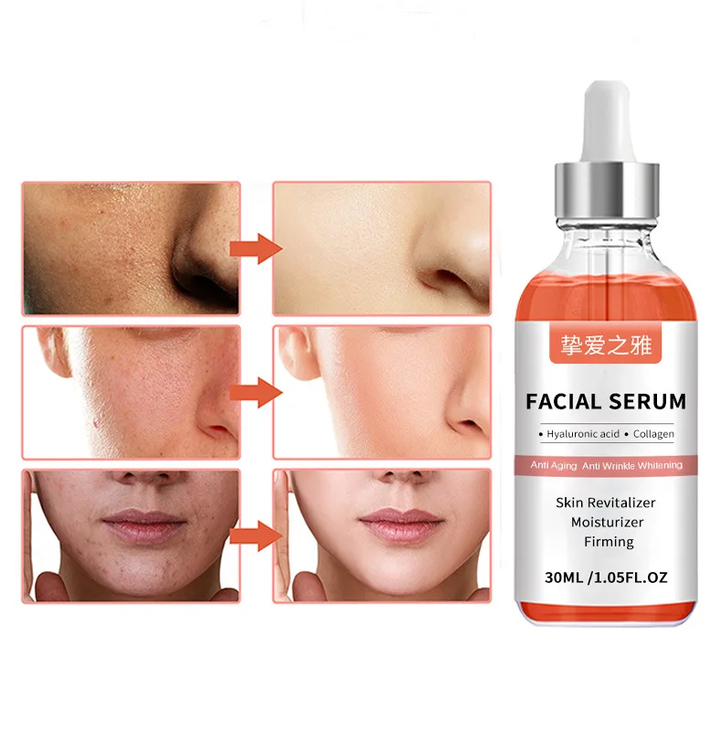 Private Label White Melas Serum Correct Dark Spots Uneven Skin Repairing Anti-Melasma Concentrate Skincare Essence Serum