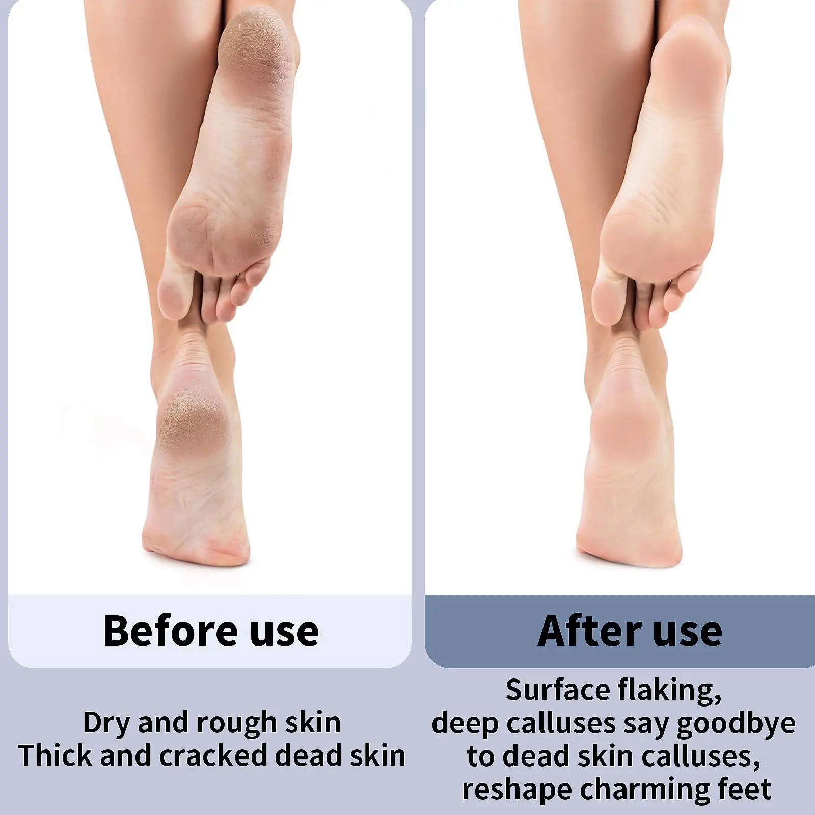 New Electric Foot Grinding Skin Hard Rupture Skin Trimmer Dead Skin Foot Pedicure Rechargeable Foot Care Tool Remover Callus