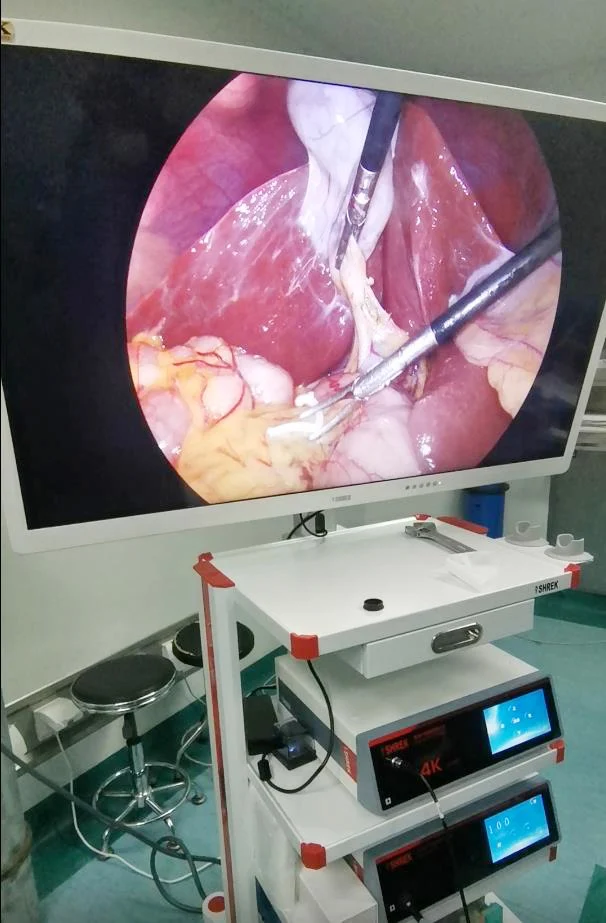 medical 4k endoscopic camera module uhd surgery system