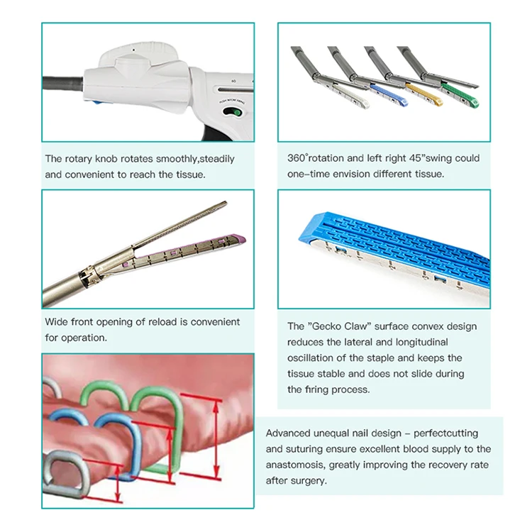 Medical Endoscopic Laparoscopic 60 Mm Stapler Endoscopic linear cutter stapler & Loading Units