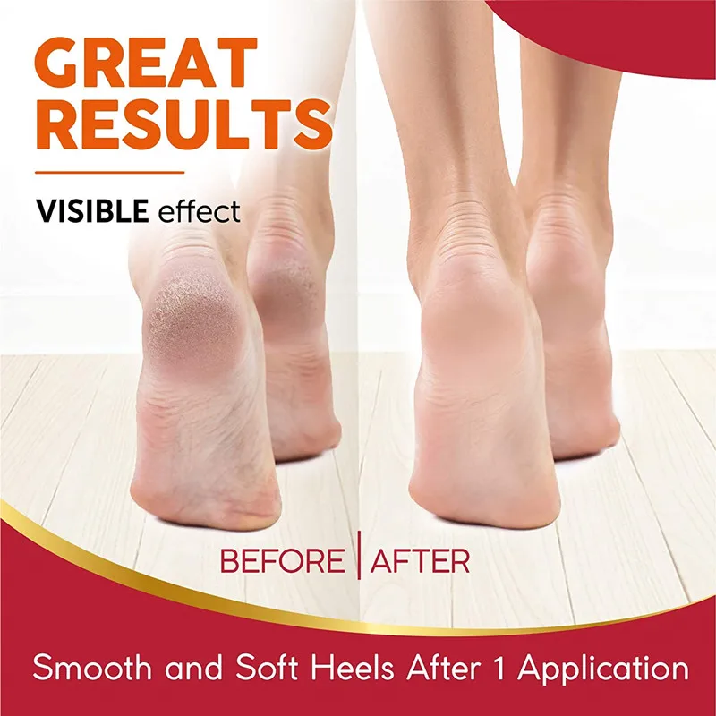 JiaJie OEM best selling Baby Soft Peeling Socks 24K Gold Foot Peel Mask