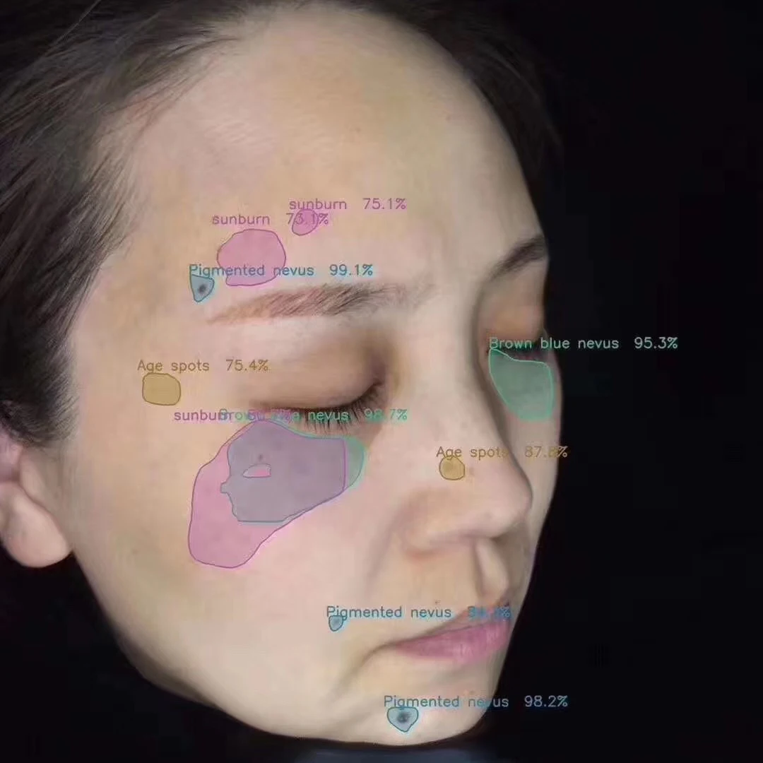 Косметическое оборудование, сканер для кожи, анализатор кожи лица DJM