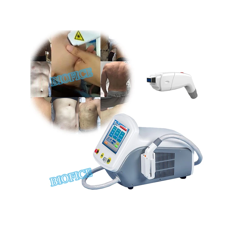 2024 newest CE TUV ISO high power 600-3500W diode laser 4 waves 755 808 940 1064nm hair removal beauty salon equipment