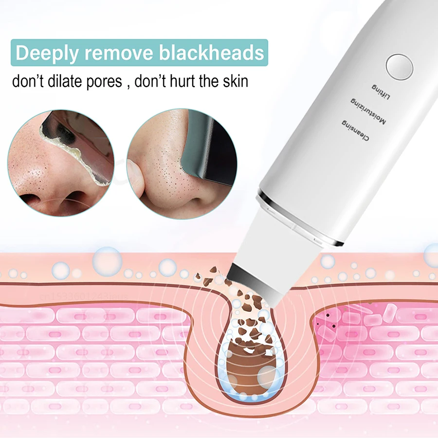 Electric Vibration Face Spatula Facial Ultrasonic Skin Scrubber blackhead remover device for deep cleansing