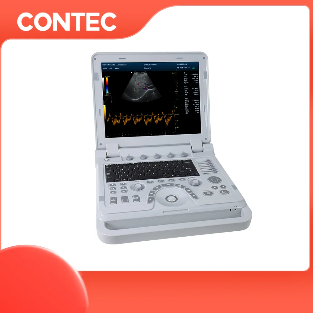 CONTEC CMS1700B portable ultrasound scanner for human being ultrasound transducer ultrasonic machine