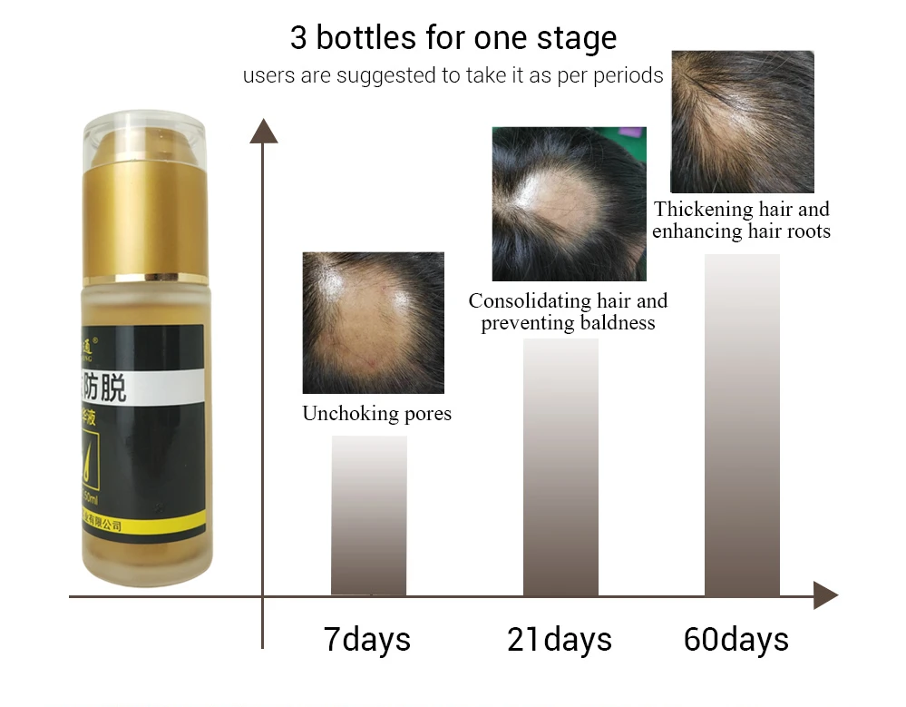 Natural wild anti hair loss private label fast hair growth oil spray for woman man