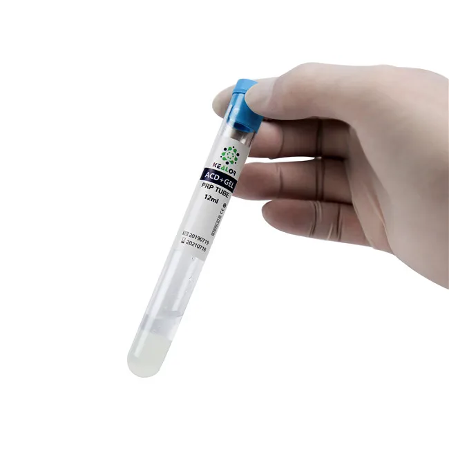 Prp tube platelet rich plasma