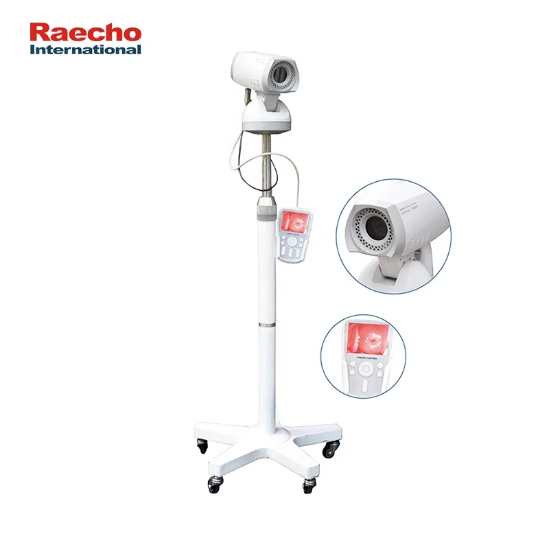 Good Quality Handheld Video Colposcope Digital Gynecology Hospital Convenient