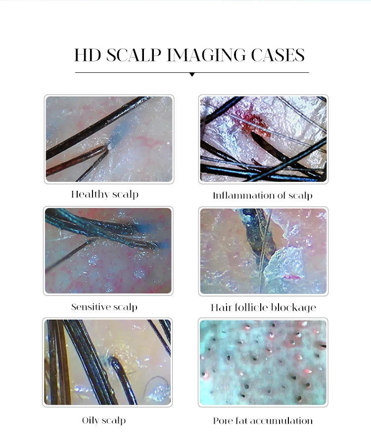 Skin Analysis Camera Photo Analysing Machines Facial Hair Scalp Scanner 200x Optical Magnification 50x Trispectral Detection