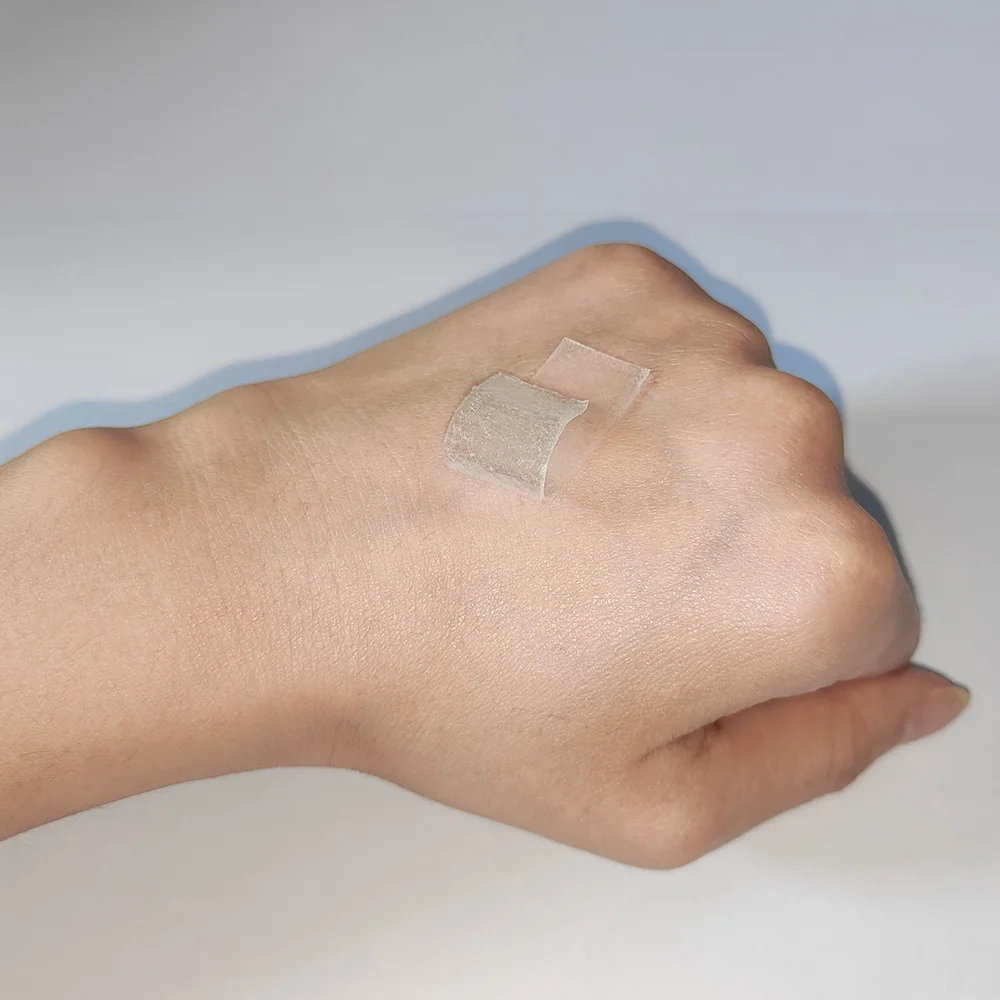 Hot Sales Skin Care Acne Scar Treatment Medical Silicone Scar Romover Sheet