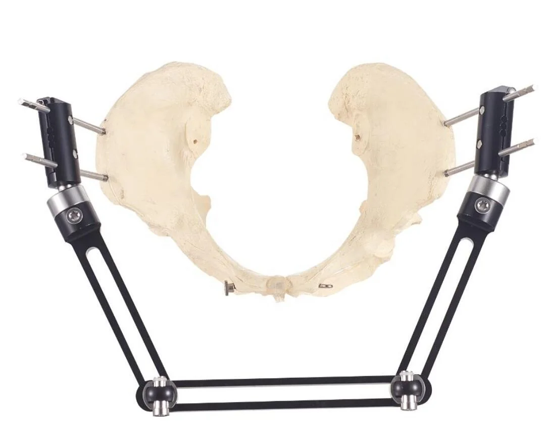 Медицинская хирургия костей, ортопедический внешний фиксатор тазовой зоны