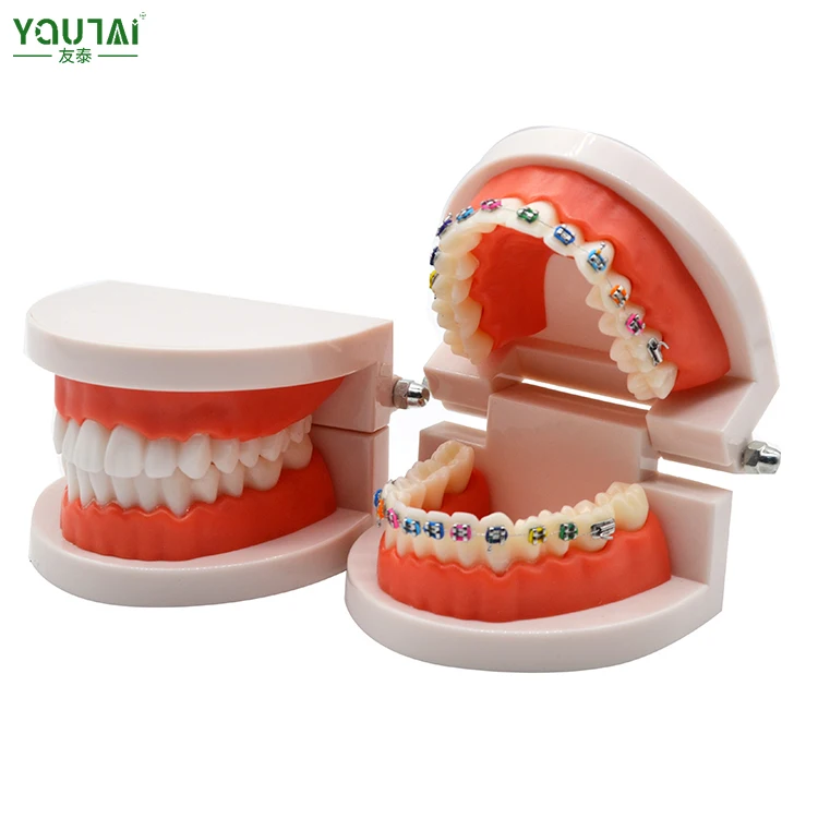Factory Direct Sale Dental Demonstration Orthodontic Treatment Model Teeth Model with Metal Bracket